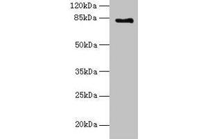 Western blot All lanes: LCA5 antibody at 18 μg/mL + Mouse kidney tissue Secondary Goat polyclonal to rabbit IgG at 1/10000 dilution Predicted band size: 81 kDa Observed band size: 81 kDa (LCA5 Antikörper  (AA 101-400))