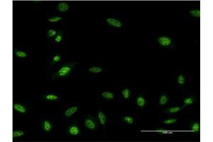 Immunofluorescence (IF) image for anti-Oligodendrocyte Lineage Transcription Factor 2 (OLIG2) (AA 2-78) antibody (ABIN523613)