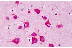 Human Brain, Cortex: Formalin-Fixed, Paraffin-Embedded (FFPE) (FKBP3 Antikörper  (AA 2-195))