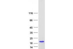 Validation with Western Blot