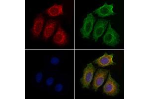 ABIN6259147 and ABIN6274943 staining Hela cells by IF/ICC. (PDE4C Antikörper  (Internal Region))