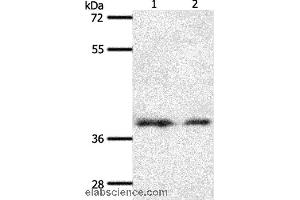 Western blot analysis of 293T and hela cell, using SSTR1 Polyclonal Antibody at dilution of 1:500 (SSTR1 Antikörper)
