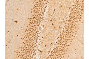 ABIN6267237 at 1/100 staining mouse brain tissue sections by IHC-P. (FOXO3 Antikörper  (pSer253))