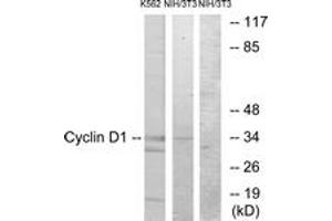 Western blot analysis of extracts from K562/NIH-3T3 cells, using Cyclin D1 (Ab-90) Antibody. (Cyclin D1 Antikörper  (AA 56-105))