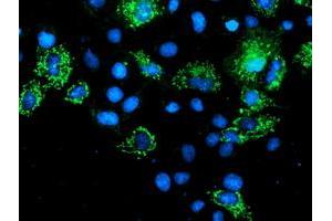 Anti-AK4 mouse monoclonal antibody (ABIN2454570) immunofluorescent staining of COS7 cells transiently transfected by pCMV6-ENTRY AK4 (RC220572). (AK4 Antikörper)
