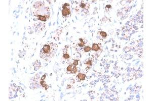 Formalin-fixed, paraffin-embedded human Pituitary stained with ACTH Rabbit Recombinant Monoclonal Antibody (CLIP/2040R). (Rekombinanter POMC Antikörper  (AA 1-24))