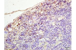 Formalin-fixed and paraffin embedded mouse spleen labeled with Rabbit Anti PLEKHM2/SKIP Polyclonal Antibody, Unconjugated (ABIN872446) at 1:200 followed by conjugation to the secondary antibody and DAB staining (PLEKHM2 Antikörper  (AA 688-750))
