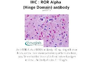 Image no. 1 for anti-RAR-Related Orphan Receptor A (RORA) antibody (ABIN1738922) (RORA Antikörper)