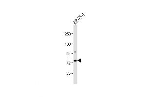 Western Blot at 1:1000 dilution + ZR-75-1 whole cell lysate Lysates/proteins at 20 ug per lane. (CTTNBP2NL Antikörper  (N-Term))