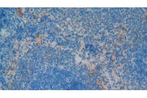 Immunohistochemistry (IHC) image for anti-Glycoprotein Ib (Platelet), beta Polypeptide (GP1BB) (AA 52-164) antibody (ABIN7439282)