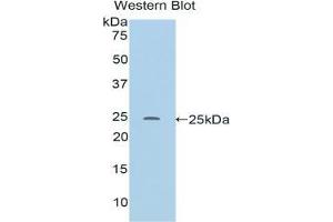 Western blot analysis of the recombinant protein. (RALBP1 Antikörper  (AA 192-380))