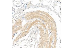 Immunohistochemistry of paraffin-embedded Human skeletal muscle using COX7 Rabbit pAb (4721) at dilution of 1:50 (40x lens). (COX7A1 Antikörper  (AA 1-79))