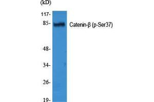 Western Blot (WB) analysis of specific cells using Phospho-Catenin-beta (S37) Polyclonal Antibody. (beta Catenin Antikörper  (pSer37))