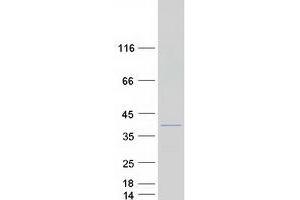 Western Blotting (WB) image for Fast Skeletal Troponin T (TNNT3) (Transcript Variant 4) protein (Myc-DYKDDDDK Tag) (ABIN2720888)