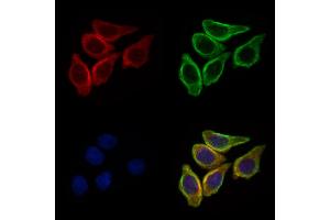 ABIN6257165 and ABIN6275114 staining HepG2 cells by IF/ICC. (EPN3 Antikörper  (Internal Region))
