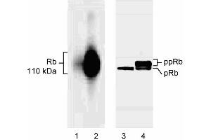 Selective binding of G99-549 to underphosphorylated Rb. (Retinoblastoma 1 Antikörper  (underphosphorylated))