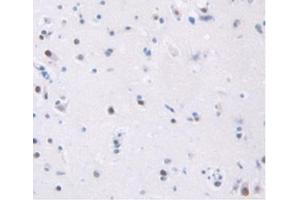 Detection of TFR in Human Brain Tissue using Anti-Transferrin Receptor (TFR) Polyclonal Antibody (Transferrin Receptor Antikörper  (AA 567-744))