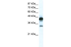 WB Suggested Anti-GJE1 Antibody Titration:  2. (GJE1 Antikörper  (C-Term))