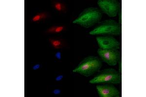 ABIN6257713 and ABIN6273763 staining  cells by IF/ICC. (ING2 Antikörper  (C-Term))