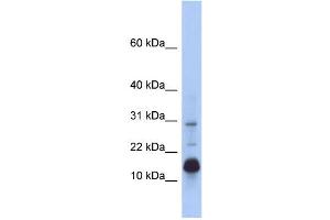 WB Suggested Anti-HIST2H2BF Antibody Titration: 0. (HIST2H2BF Antikörper  (N-Term))