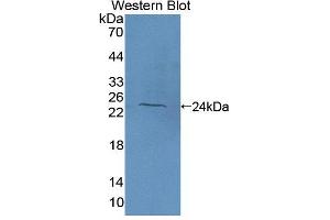 Figure. (TBXAS1 Antikörper  (AA 357-533))
