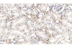 Detection of GSN in Bovine Kidney Tissue using Monoclonal Antibody to Gelsolin (GSN) (Gelsolin Antikörper  (AA 170-423))