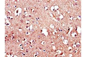 Immunohistochemistry of paraffin-embedded human brain tissue using ABIN7158114 at dilution of 1:100 (LRRTM4 Antikörper  (AA 259-419))