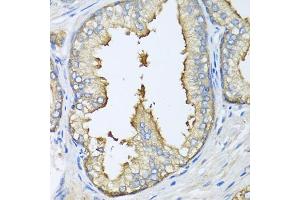 Immunohistochemistry of paraffin-embedded human prostate using ATG5 antibody. (ATG5 Antikörper)