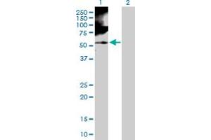 Lane 1: RBMS1 transfected lysate ( 44.