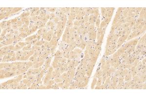 Detection of NT-ProBNP in Human Cardiac Muscle Tissue using Monoclonal Antibody to N-Terminal Pro-Brain Natriuretic Peptide (NT-ProBNP) (NT-ProBNP Antikörper)
