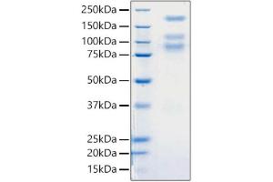 SDS-PAGE (SDS) image for SARS-CoV-2 Spike (ECD) (Active) protein (His tag) (ABIN6952734)
