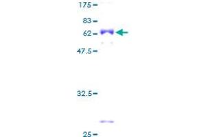 CCBL1 Protein (AA 1-374) (GST tag)