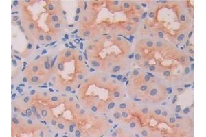 Detection of HEXb in Human Kidney Tissue using Polyclonal Antibody to Hexosaminidase B Beta (HEXb)