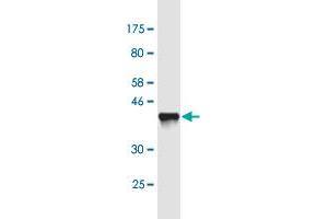 Western Blot detection against Immunogen (37. (ZNF274 Antikörper  (AA 420-530))