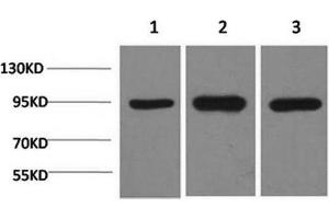 Western Blot analysis of 1) Hela, 2)Mouse brain, 3) Rat brain using HSP90 alpha Monoclonal Antibody at dilution of 1:2000. (HSP90AA2 Antikörper)