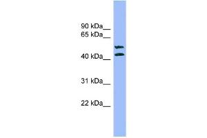 WB Suggested Anti-TMPRSS3 Antibody Titration: 0. (TMPRSS3 Antikörper  (N-Term))