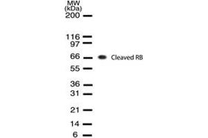 Image no. 1 for anti-Retinoblastoma Protein (Rb Protein) (Cleavage Site) antibody (ABIN207915) (Retinoblastoma Protein (Rb) Antikörper  (Cleavage Site))