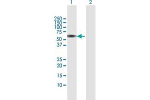 Western Blot analysis of CEP55 expression in transfected 293T cell line by CEP55 MaxPab polyclonal antibody. (CEP55 Antikörper  (AA 1-464))