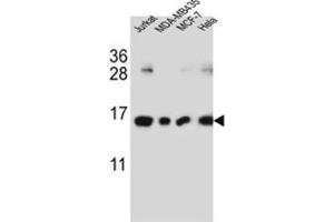 Western Blotting (WB) image for anti-H2A Histone Family, Member J (H2AFJ) antibody (ABIN3002385) (H2AFJ Antikörper)