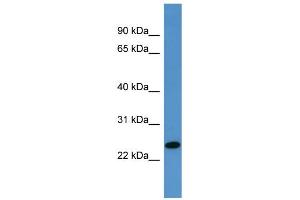 WB Suggested Anti-TP53INP1 Antibody Titration: 0. (TP53INP1 Antikörper  (C-Term))
