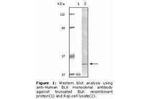 Image no. 2 for anti-B Lymphoid Tyrosine Kinase (BLK) antibody (ABIN232110) (BLK Antikörper)
