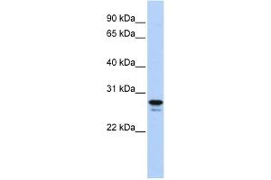 WB Suggested Anti-HMGB2 Antibody Titration: 0. (HMGB2 Antikörper  (Middle Region))