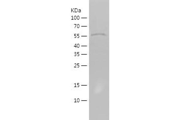 ATF6 Protein (AA 1-182) (His-IF2DI Tag)