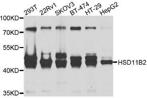 Western blot analysis of extracts of various cells, using HSD11B2 antibody.