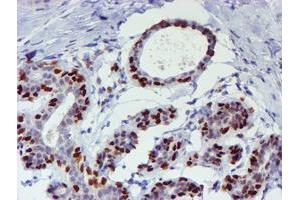 Immunohistochemical staining of paraffin-embedded Human breast tissue using anti-WWTR1 mouse monoclonal antibody. (WWTR1 Antikörper)