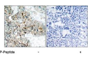Image no. 1 for anti-Integrin beta 3 (ITGB3) (pTyr773) antibody (ABIN196720) (Integrin beta 3 Antikörper  (pTyr773))