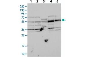 Western blot analysis of Lane 1: RT-4, Lane 2: U-251 MG, Lane 3: Human Plasma, Lane 4: Liver, Lane 5: Tonsil with NARFL polyclonal antibody  at 1:250-1:500 dilution. (NARFL Antikörper)