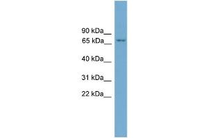 WB Suggested Anti-PRKCH AntibodyTitration: 1.