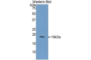 Detection of recombinant NUCB2 using Polyclonal Antibody to Nucleobindin 2 (NUCB2) (NUCB2 Antikörper  (AA 108-246))