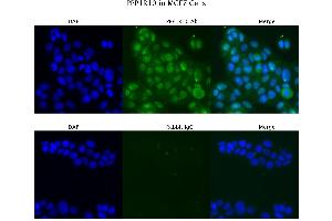 Sample Type :  MCF7   Primary Antibody Dilution:  4 ug/ml   Secondary Antibody :  Anti-rabbit Alexa 546   Secondary Antibody Dilution:  2 ug/ml   Gene Name :  PPP1R10 (PPP1R10 Antikörper  (N-Term))